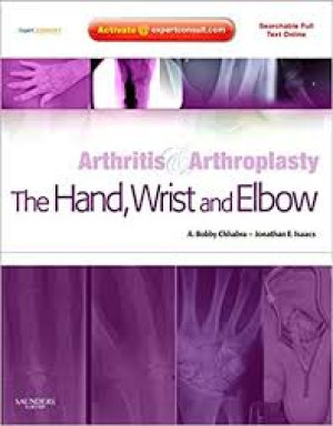 Image of Arthritis & Arthroplasty: The Hand, wrist, and elbow